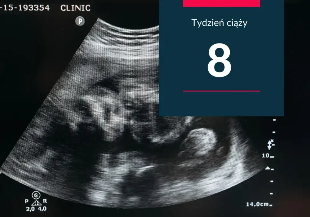 Ósmy tydzień ciąży - co pokazuje USG i kiedy zgłosić się do lekarza?
