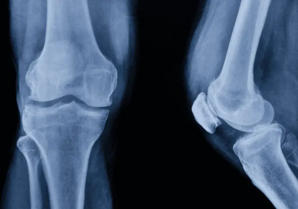Anatomia kolana: Kompendium wiedzy o budowie i funkcjach