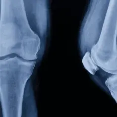 Anatomia kolana: Kompendium wiedzy o budowie i funkcjach