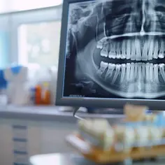 Ile kosztuje zdjęcie RTG zębów? Cennik usług stomatologicznych w 2025 roku