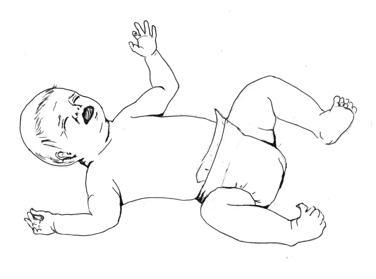 Niemowlę z otwartymi ustami i uniesionymi rączkami, wyginające się w łuk. To ilustracja odruchu Moro.