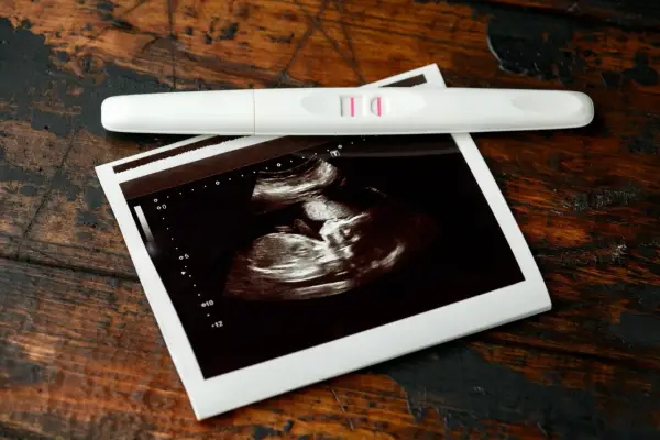 7. tydzień ciąży - jak duży jest zarodek i co widać w USG?