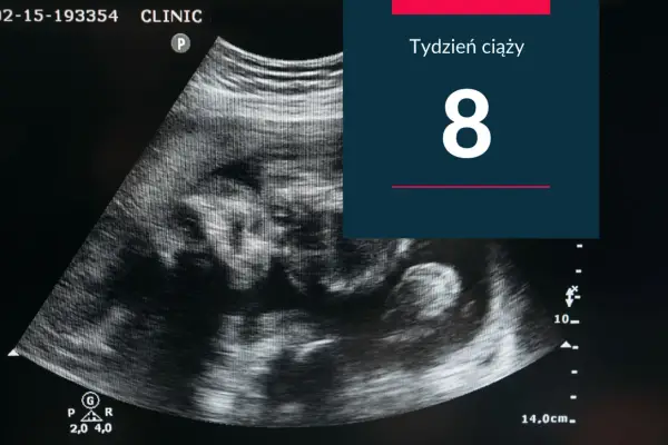 Ósmy tydzień ciąży - co pokazuje USG i kiedy zgłosić się do lekarza?